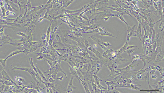 セルナ脂肪幹細胞